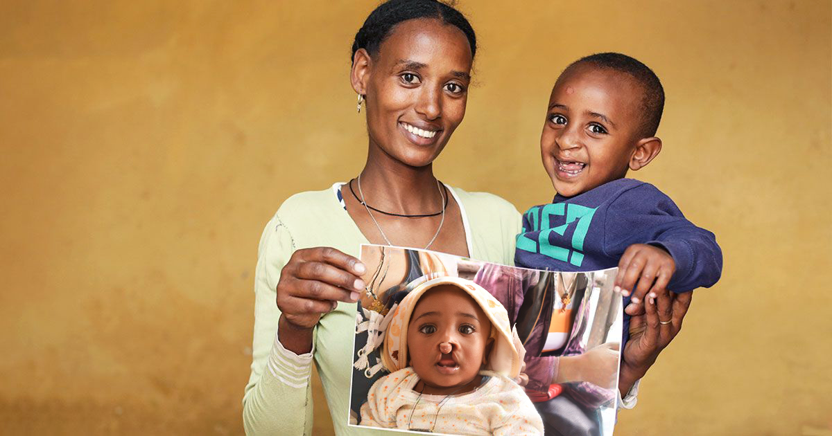 Raising Cleft and Craniofacial Awareness With SmileTrain